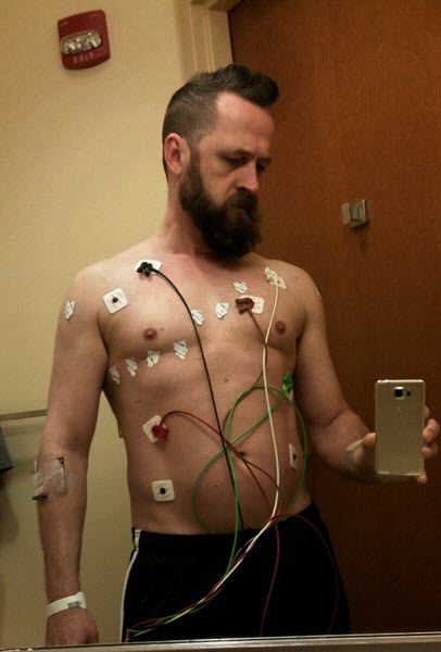 ekg-pads.jpg